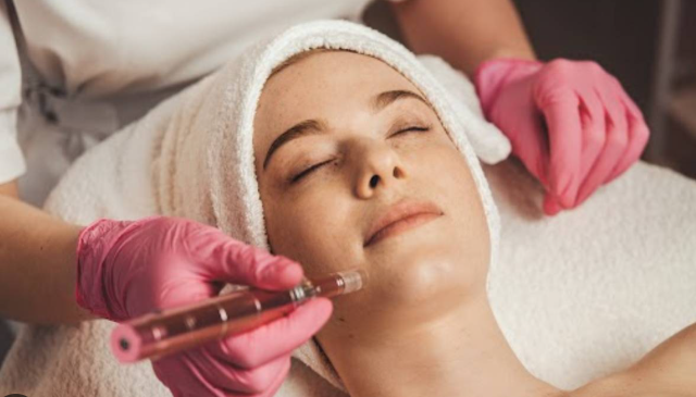 What Is Microneedling in At-Home Beauty Care?