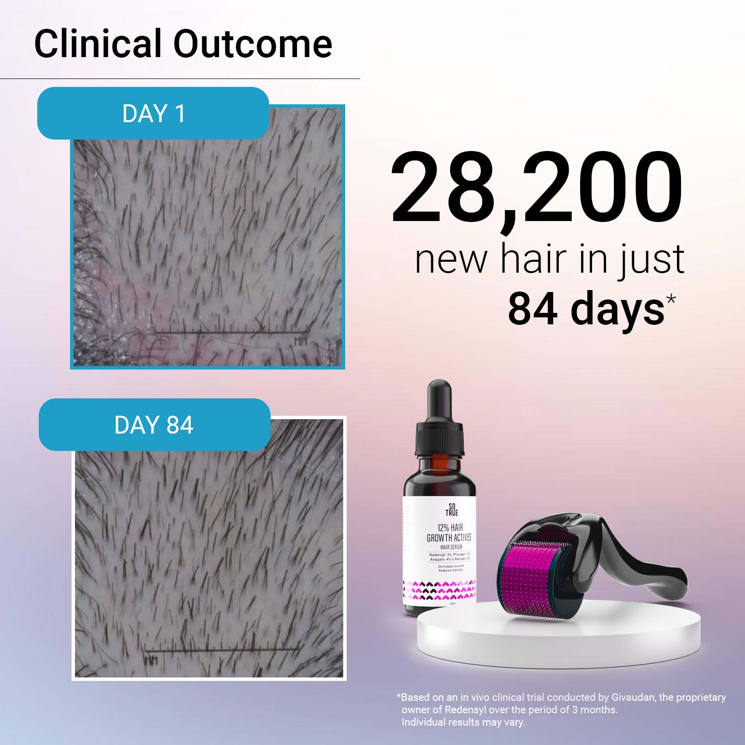 Hair Revival Combo | Derma Roller 1mm & Hair Growth Serum
