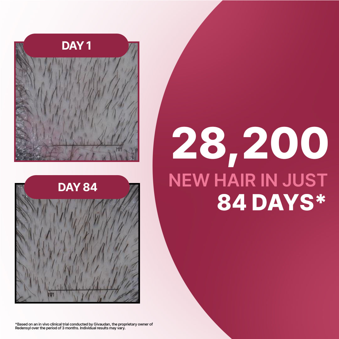 Hair Growth Serum | 12% Hair Growth Actives