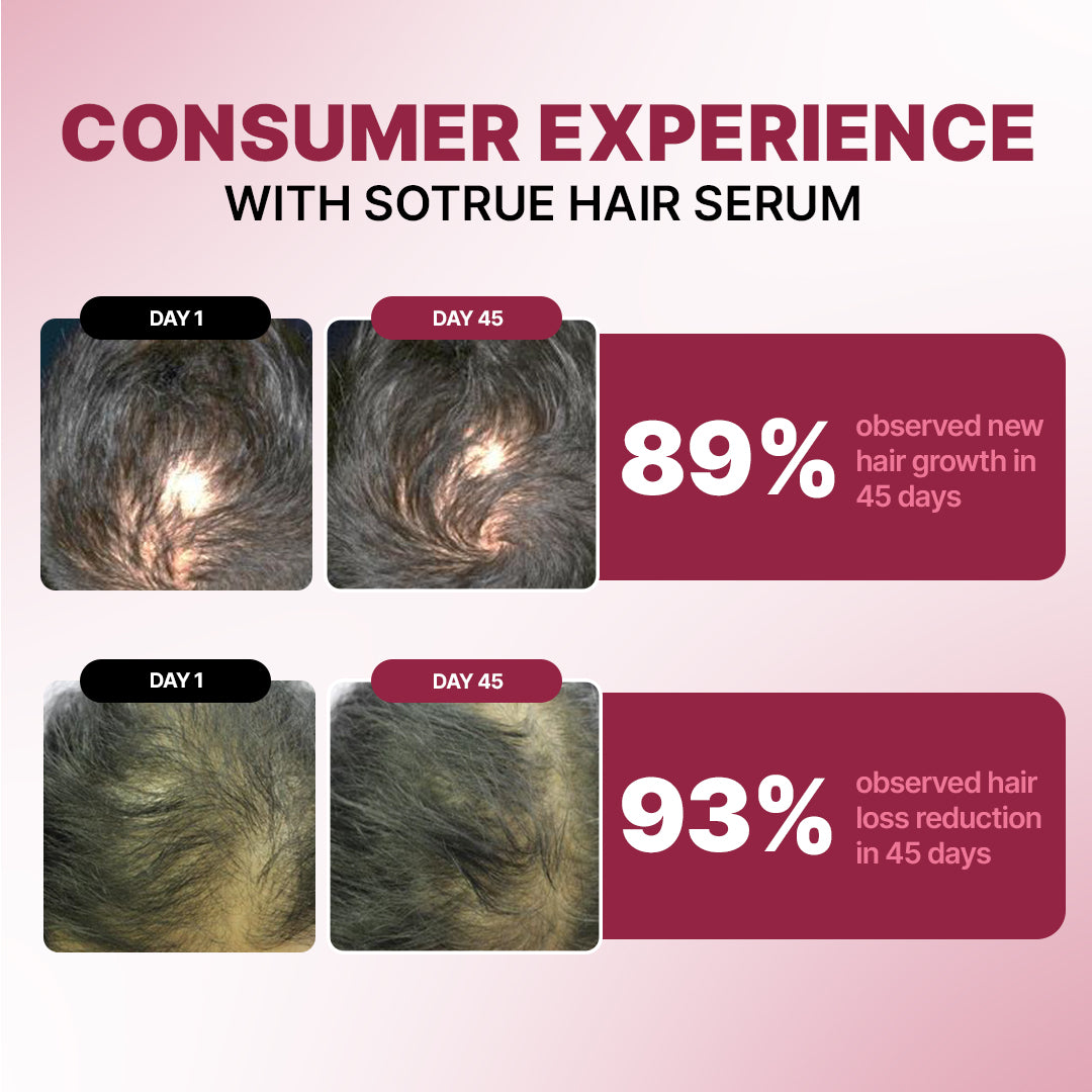 Hair Growth Serum | 12% Hair Growth Actives
