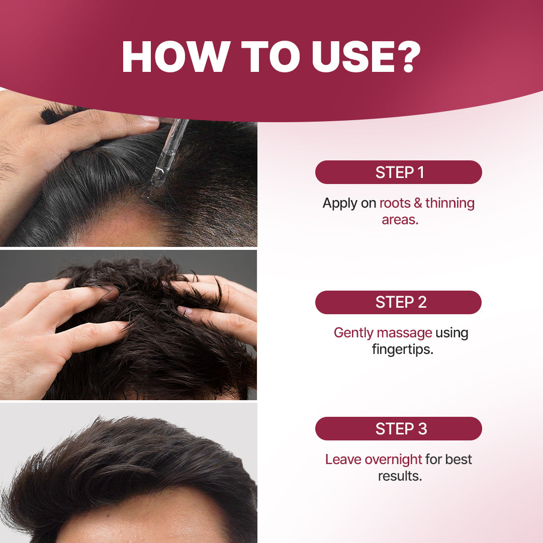 Hair Growth Serum | 12% Hair Growth Actives