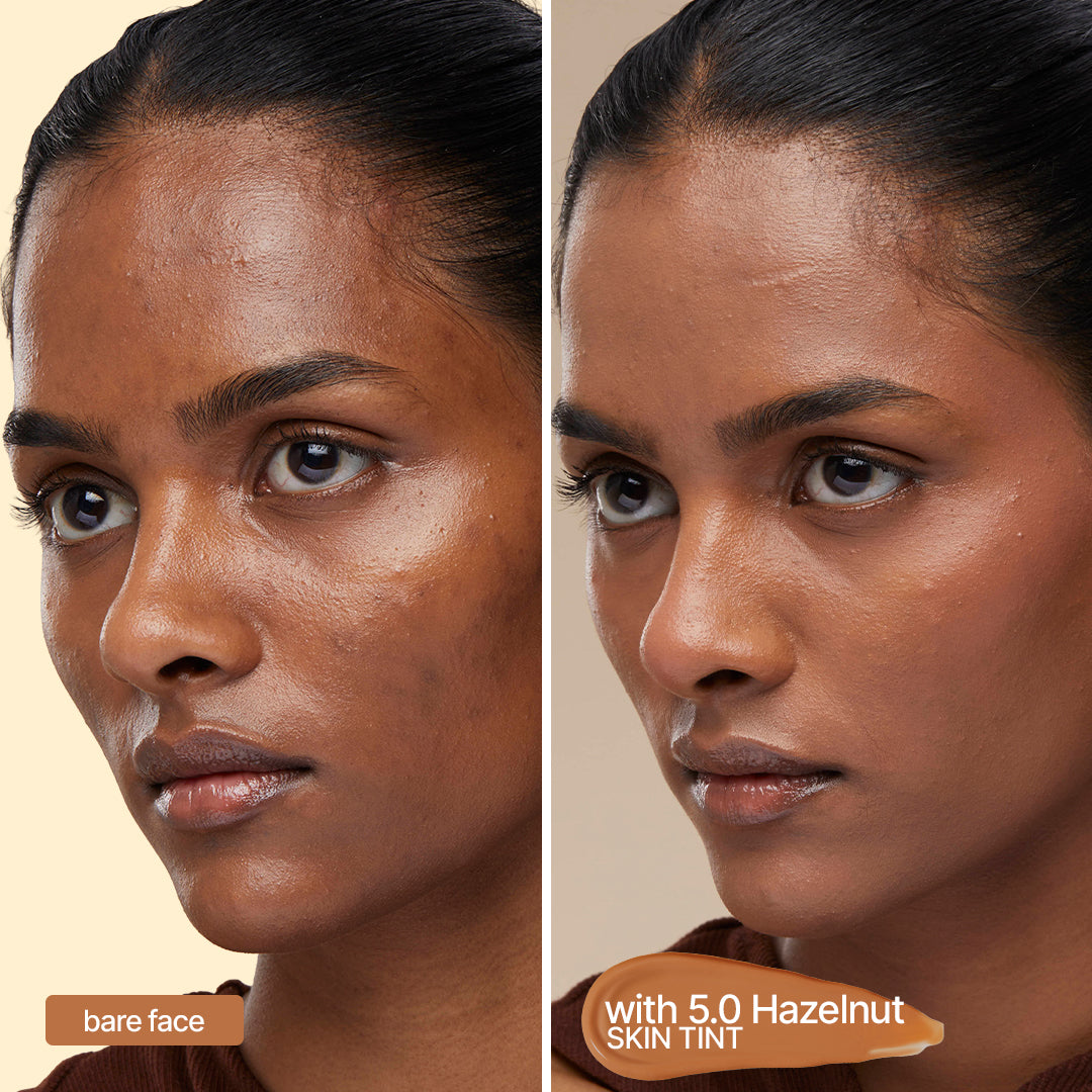 Sotrue 4-in-1 Skin Tint in 5.0 Hazelnut - light to medium coverage with SPF 30, evens tone in one step - bare face beside the same face wearing it
