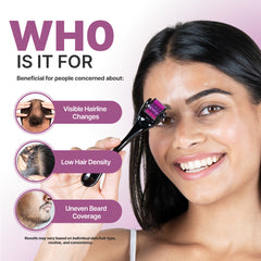 Derma Roller | 540 0.5mm Titanium Micro Needles | Sotrue
