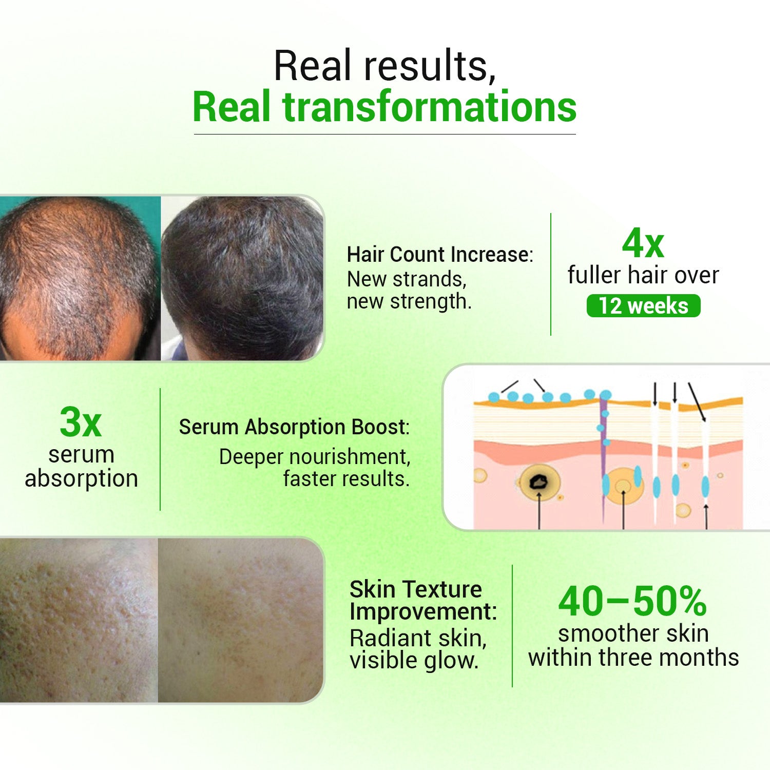 Epifine Derma Roller (0.5mm) | Microneedling
