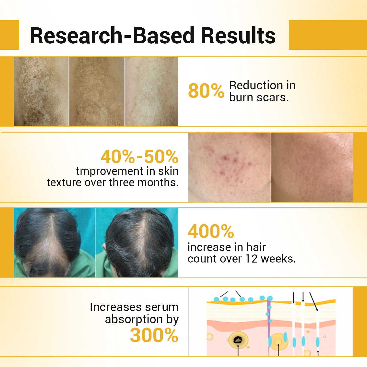 Derma Roller Professional 1mm | For Hair & Skin