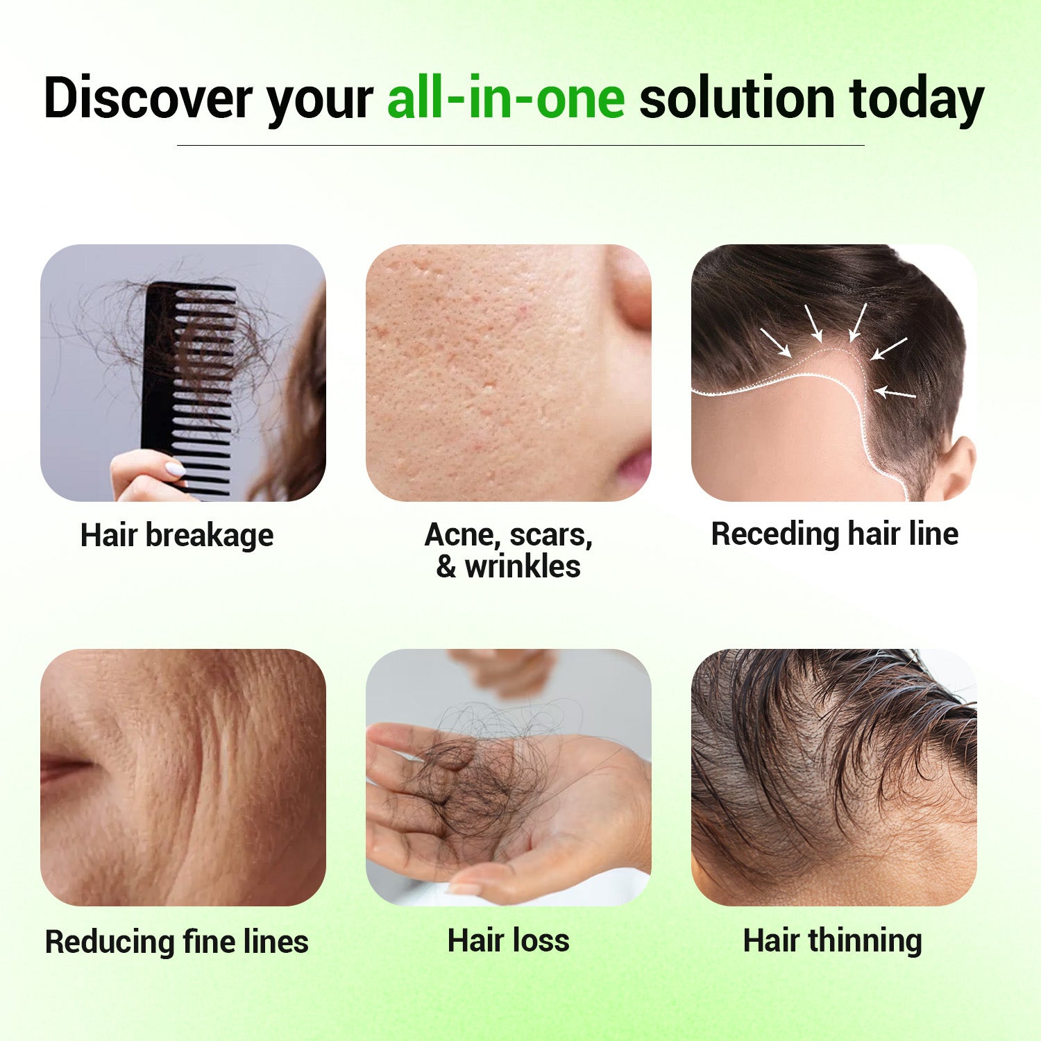 Epifine Derma Roller (0.5mm) | Microneedling